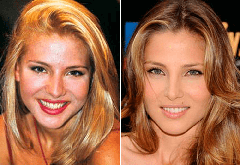 Antes-Despues-Elsa-Pataky
