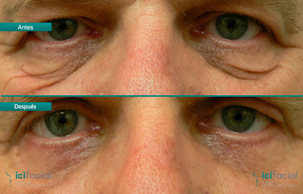 Cirugías estéticas más demandadas