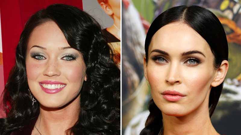 Antes y después en la bichectomía de Megan Fox