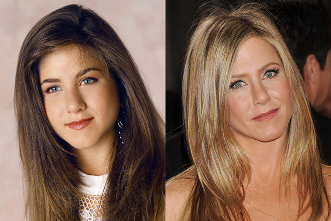 Rinoplastia Jennifer Aniston