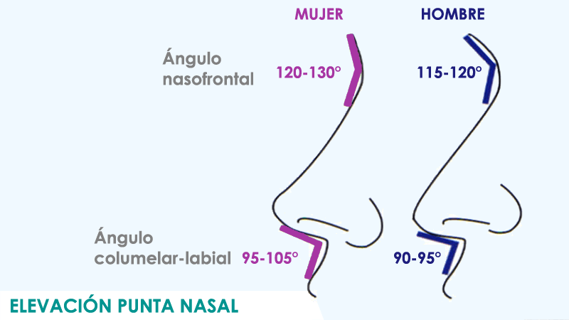 Elevar la punta de la nariz en Madrid con cirugía de rinoplatia