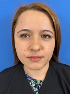 Fotografía de frente para valoración de rinpolastia por el Doctor Macía