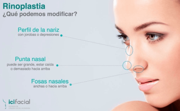 Que se puede modificar con la rinoplastia