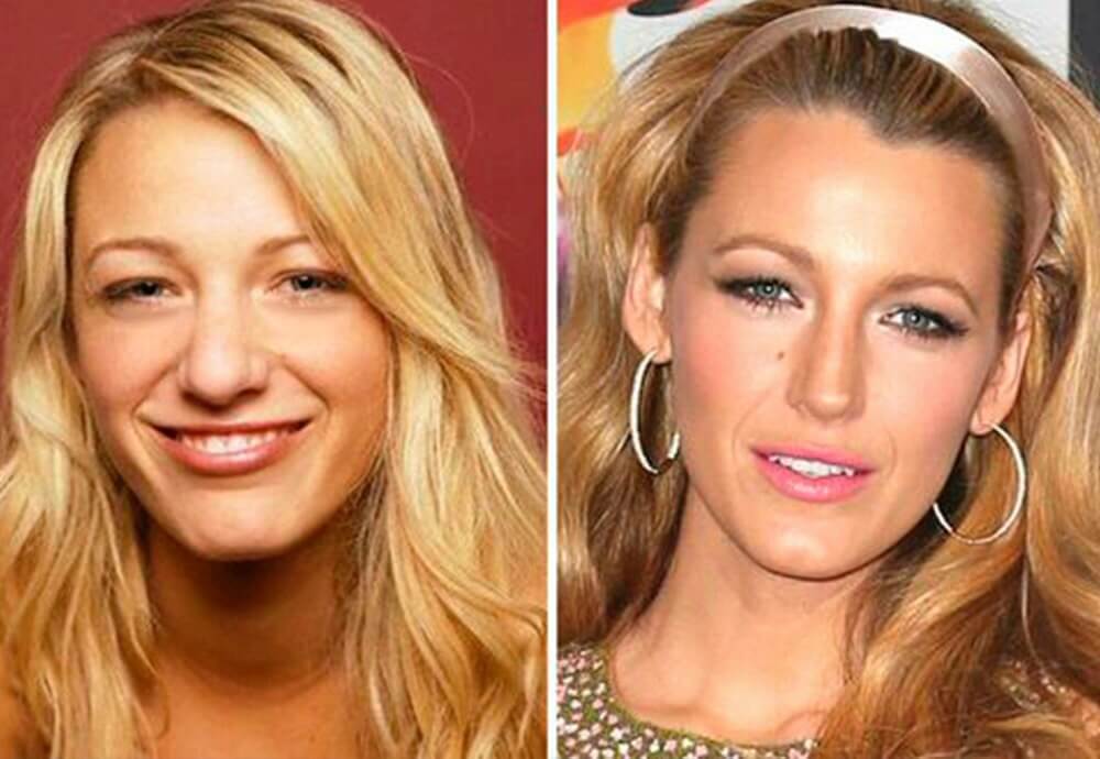 Antes-Despues-Blake-Lively