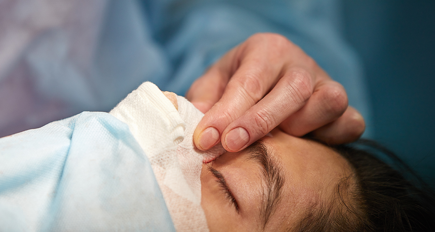 ¿Por qué se usan los injertos durante la rinoplastia?