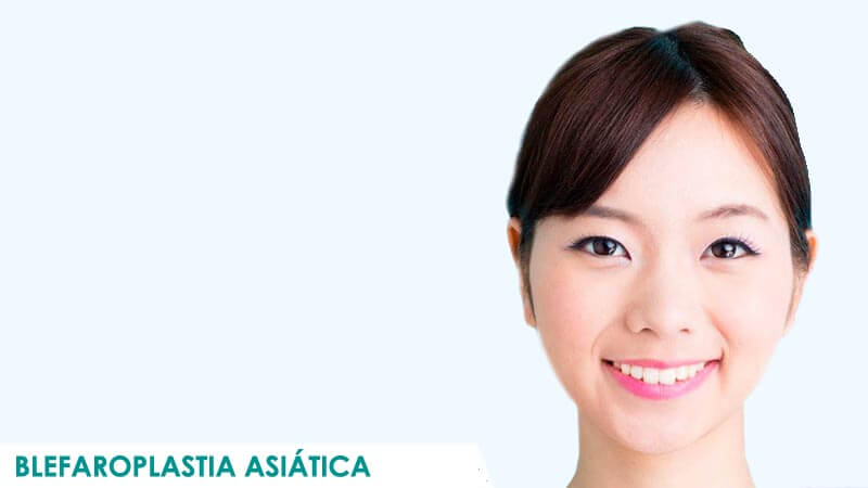 Operación de blefaroplastia asiática en Madrid por Dr. Macía