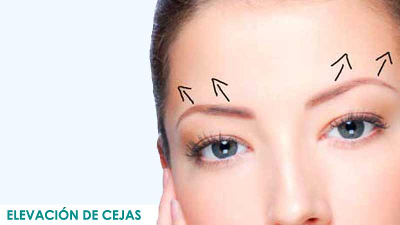 Cirugía elevación de cejas en Madrid