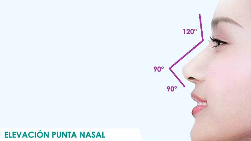 Elevar punta nariz en Madrid con rinoplastia o rinomodelacion