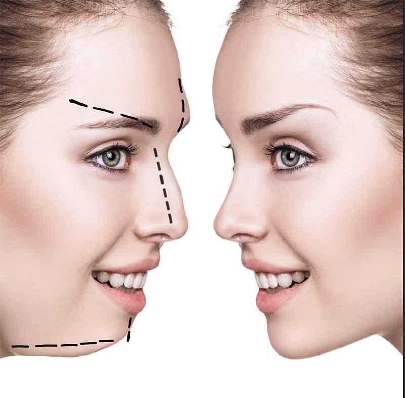 Cirugía estética para usuarios de la revista Wondergay