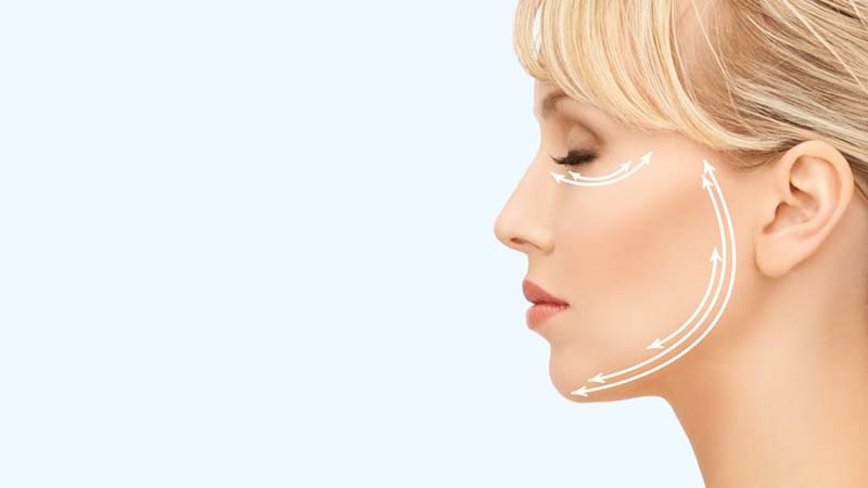 Lifting facial para rejuvenecimiento del rostro