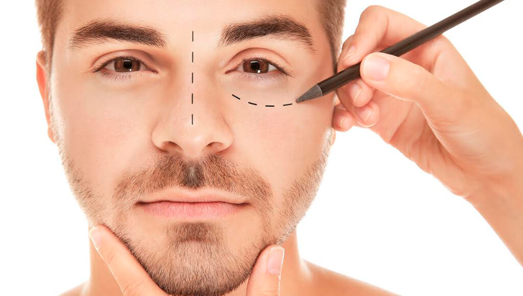Mitos más extendidos en la cirugía facial