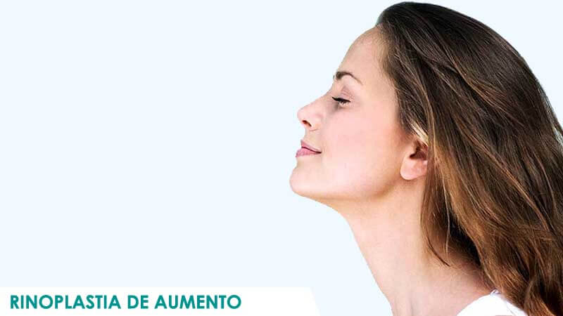 Rinoplastia de aumento en Madrid por Dr. Macía