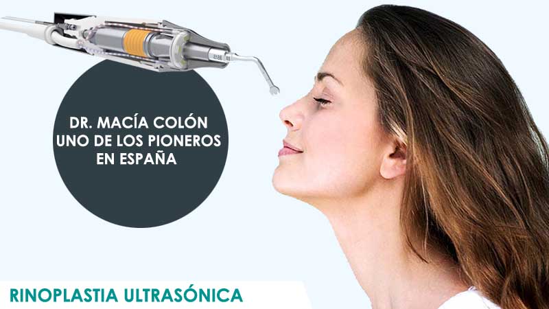 Rinoplastia por ultrasonidos realizada por el Dr. Macía de Icifacial