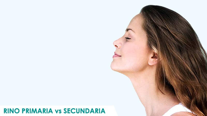 Rinoplastia primaria y secundaria en Madrid