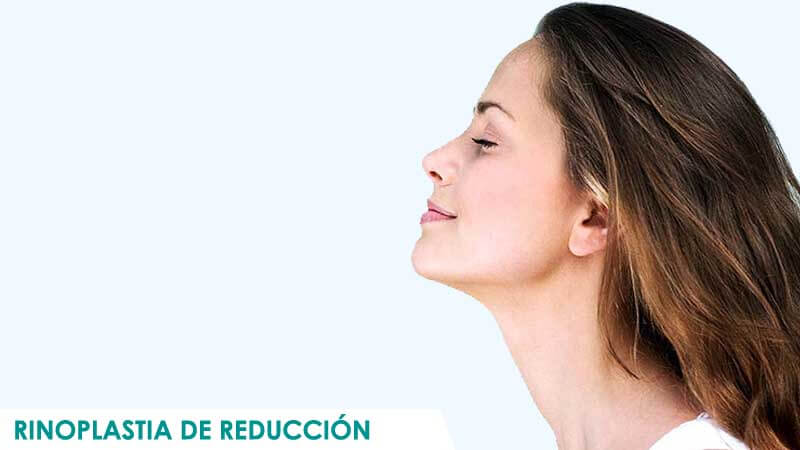 Rinoplastia de reducción en Madrid por Dr. Macía Colón