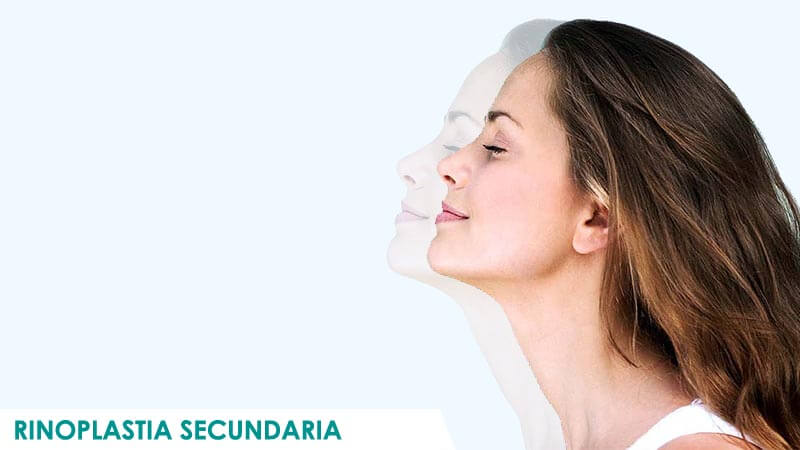 Rinoplastias primaria y secundaria en Madrid