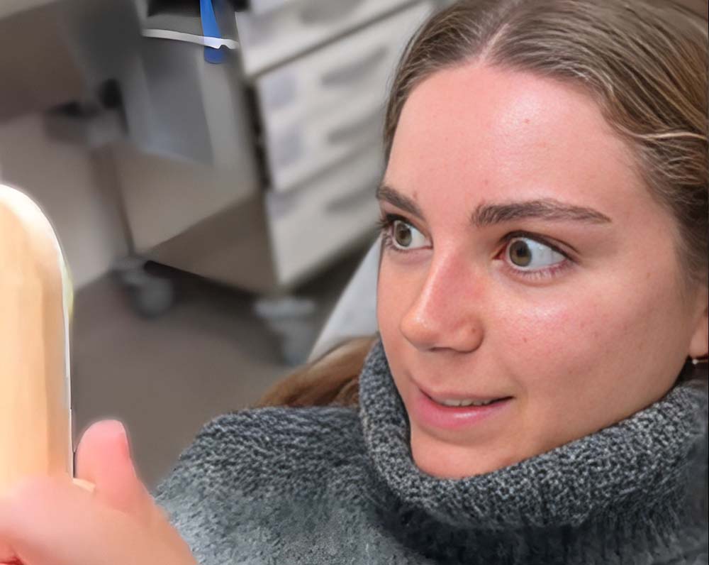 Rinoplastia retirada de ferula versus rinomodelación