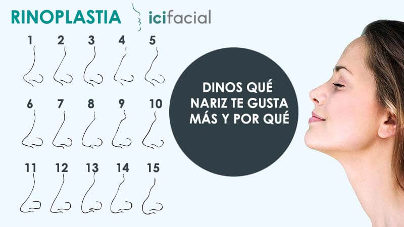 Tipos de nariz para rinoplastia que pueden operarse